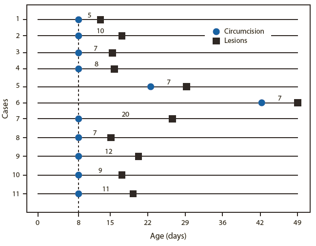 The figure consists of 11 timelines, showing the number of days between Jewish ritual circumcision and appearance of herpes lesions, among 11 male infants with neonatal herpes following Jewish ritual circumcision with confirmed or probable orogenital suction in New York City, during 2000-2011. The number of days from circumcision to lesions rangs from 5 to 20, with a median of 8 days.